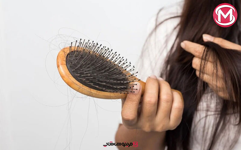 دلایل ریزش مو در زنان چیست؟