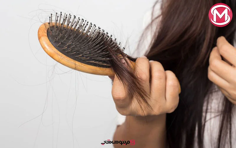 چقدر ریزش مو طبیعی است؟