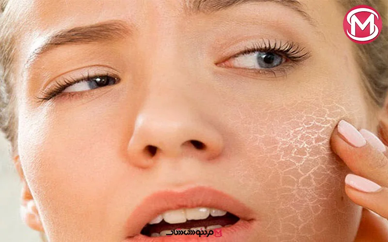 ویژگی‌های بارز یک ضد آفتاب که برای پوست خشک به کار می‌رود