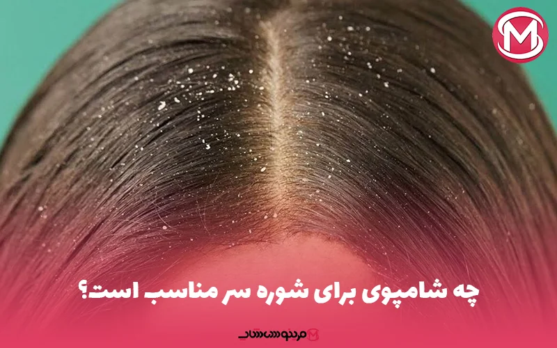 چه شامپوی برای شوره سر مناسب است؟