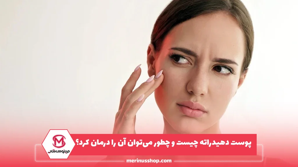 پوست دهیدراته چیست و چطور می‌توان آن را درمان کرد؟