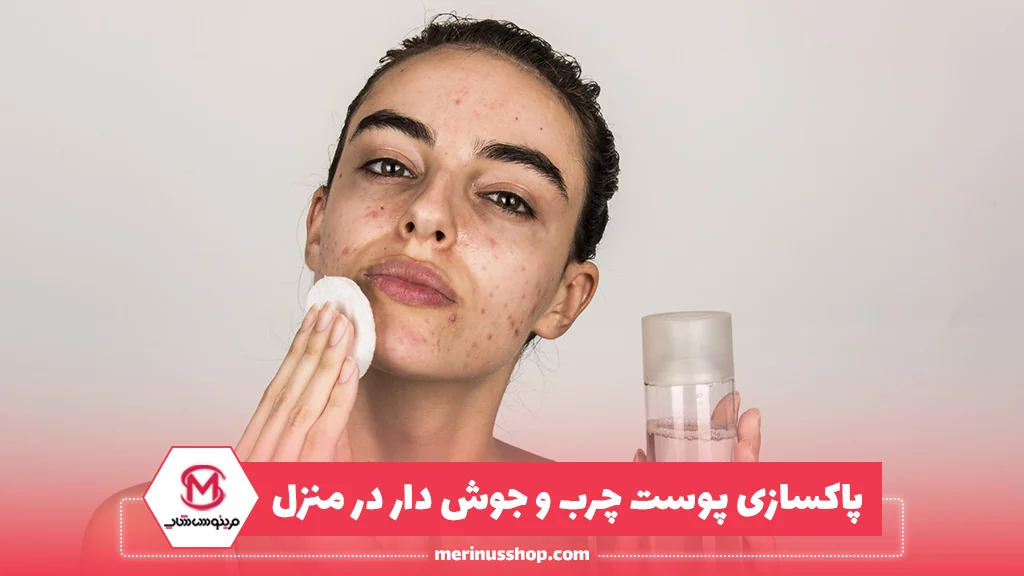 پاکسازی پوست چرب و جوش دار در منزل